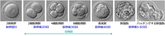 胚培養タイムラプス画像